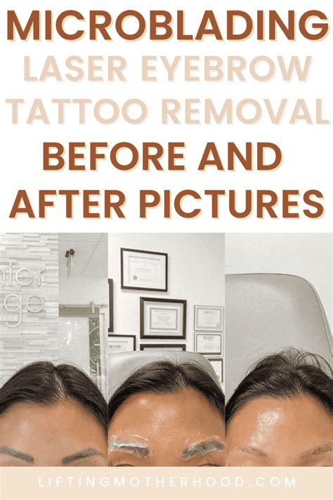 Microblading And Eyebrow Tattoo Removal Experience - Lifting Motherhood LLC