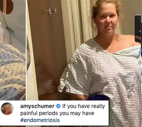 Amy Schumer's Inspiring Weight Loss Transformation | Fabbon
