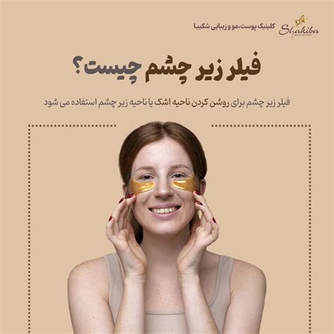 فیلر زیر چشم چیست؟ + فیلم تزریق + فواید! | کلینیک شکیبا