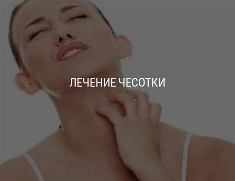 Чесотка — симптомы, первые признаки, лечение чесотки в домашних ...