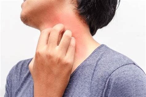 Itchy Skin (pruritus) - WISE Medical Center