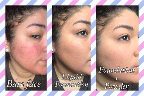 Best Liquid Mineral Foundation For Rosacea at Thomas Gabaldon blog