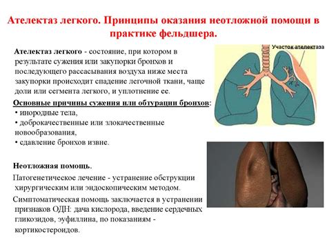 Анатомо-физиологические особенности лёгких. (Лекция 11) - презентация ...