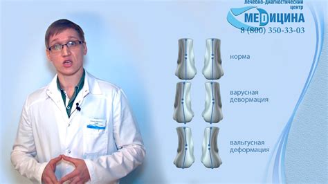 Ортопедические Стельки - YouTube
