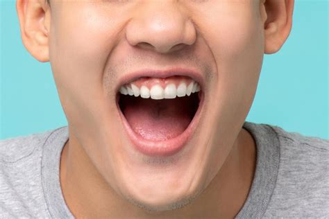 anatomi mulut manusia bagian  fungsi lengkap  sehat