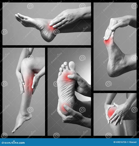 Pain in the Foot. Massage of Female Feet. Sore on Woman Legs. Pain in