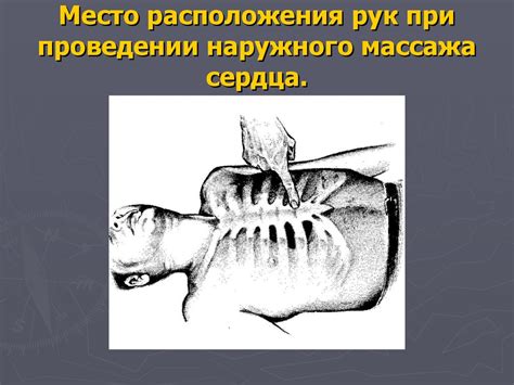 Сердечно-легочно-мозговая реанимация - презентация онлайн