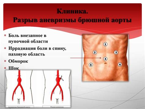 Острая абдоминальная боль - презентация онлайн