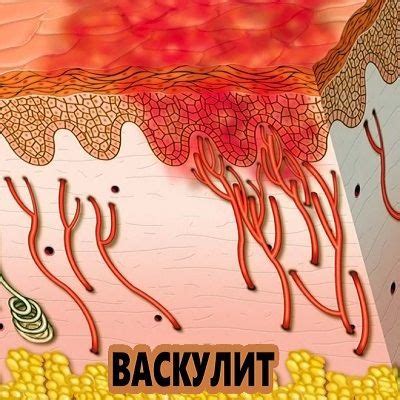Выбрать препараты при определенном диагнозе, поиск препаратов