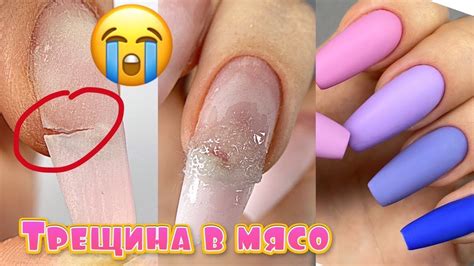 Трещина в мясо 😬 Ремонт нарощенных ногтей ватой без акригеля ...
