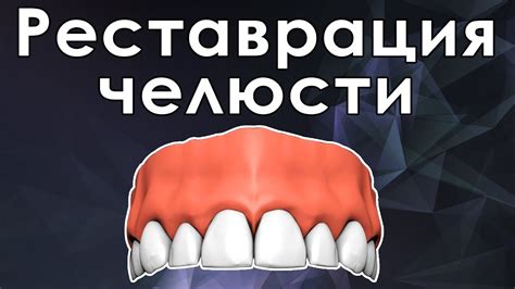 Дистракционный остеогенез всей верхней челюсти - YouTube