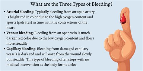 Types Of Bleeding Gastrointestinal (GI) Bleeds > Types Of Bleeds >