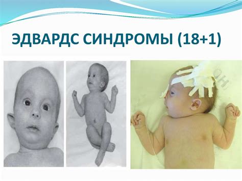 Туа биткен ақаулар - презентация онлайн