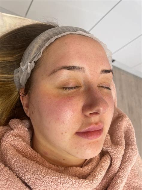 Luxury Hydrafacial - DermaPharm Aesthetics