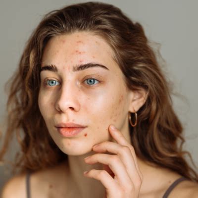 zit   zit    shouldnt mess