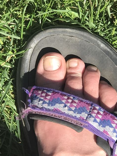 Why is my toe next to big toe indenting when I walk? I have a hammertoe