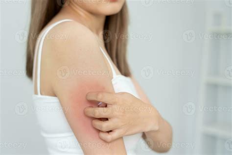 skin problem and beauty. Young woman scratch body has itchy skin from ...