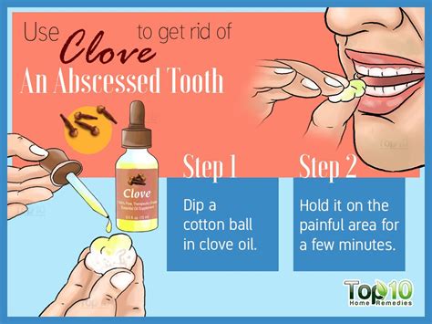 Tooth Abscess Home Treatment