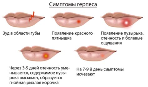 Шишка на губе с внутренней стороны и снаружи, шарики и уплотнения на ...