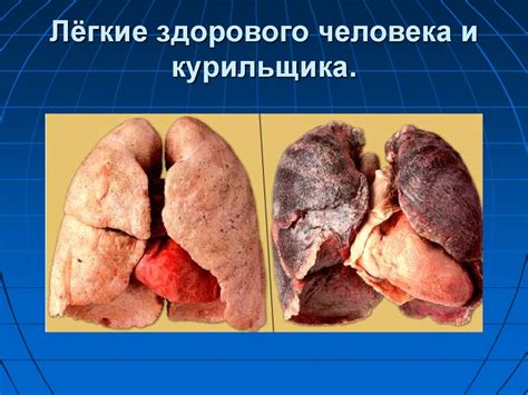 Гражданин. Права и обязанности. Подросток в обществе риска ...