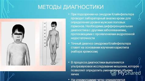 Презентация на тему: "СИНДРОМ КЛАЙНФЕЛЬТЕРА Выполнила: студентка 5 ...