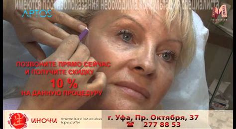 ИНОЧИ нити аптос - YouTube