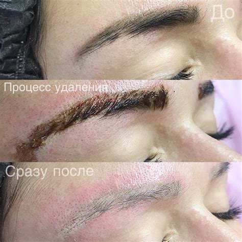 Ремувер для удаления татуажа бровей
