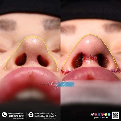ent clinic  excellence dubai entclinicae