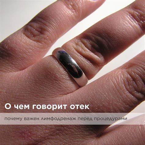 О чем говорит отек?