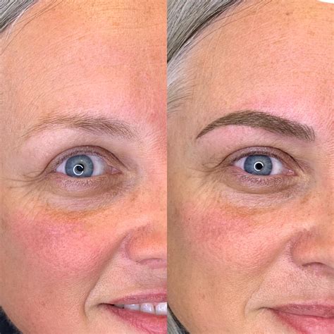 Cosmetic tattooing- Combination brows, a cross between microblading and