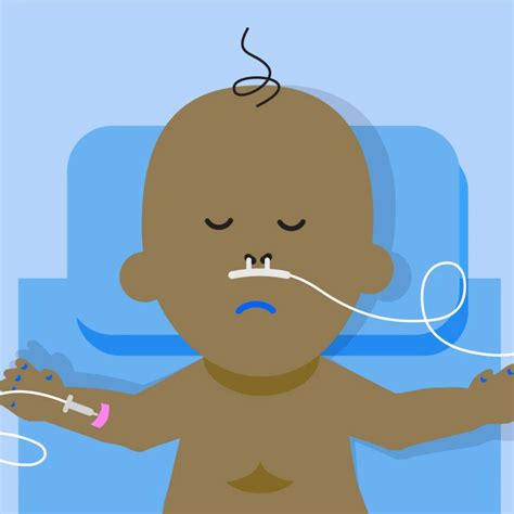 RSV Prevention and Treatment | American Lung Association