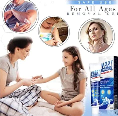 Instant Wart Removal Cream - 100g