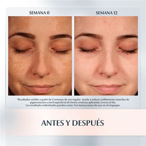 Eucerin Pigment Antes E Depois - Crema Facial de Noche Antimanchas con Thiamidol | Eucerin