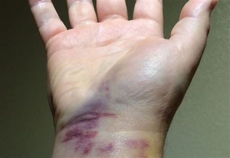 'It's Just A Broken Wrist,' Says Dad Refusing To See Doctor | Classic Dad