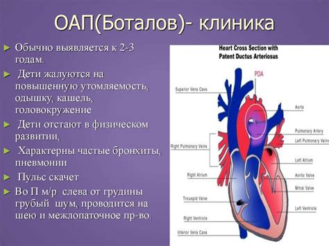 Врожденные пороки сердца у детей (ВПС) - презентация онлайн