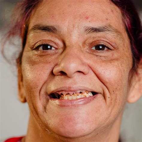 Nuvia TV (Real Dental Implant Stories)