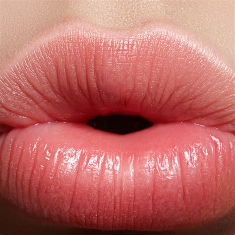 What To Do After Lip Fillers - Laseraid Australia