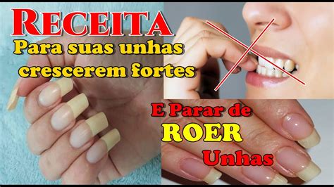 O Que Fazer Para Parar De Roer Unha - Receita para parar de Roer As unhas e Fazer elas crescerem Rápido - YouTube