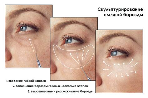Что Такое Борозда Фото — Фото