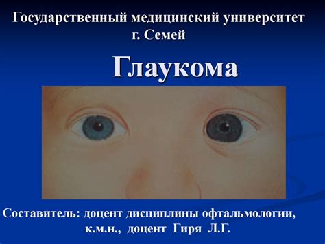 Глаукома. Методы исследования - презентация онлайн