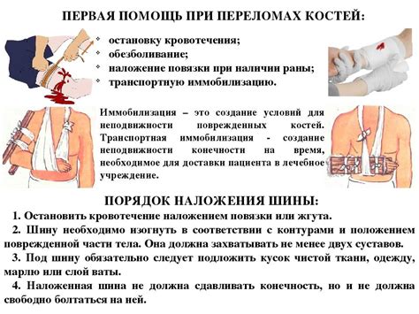 Наложение повязки при переломе ребра: как сделать корсет из бинта
