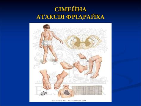 Спадкові захворювання нервової системи - презентация онлайн