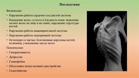 Анорексия – это в голове - презентация онлайн