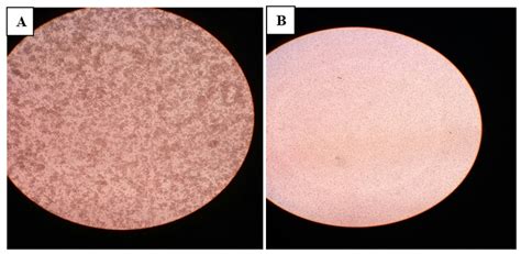 Haemagglutination: (A) Showing haemagglutination under 10x; (B):... | Download Scientific Diagram