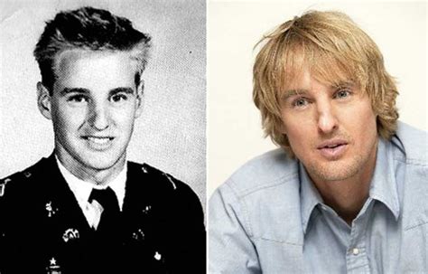 Owen Wilson Nose Job: Plastic Surgery and Rhinoplasty