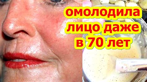 За 8 Минут Омолодила Лицо Даже в 70 лет ! Маска от Глубоких Морщин skin ...