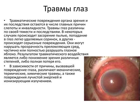 Глазные болезни. Дакриоаденит, дакриоцистит - презентация онлайн
