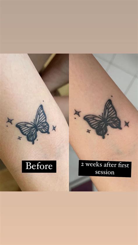 what to do when your tattoo is peeling 8