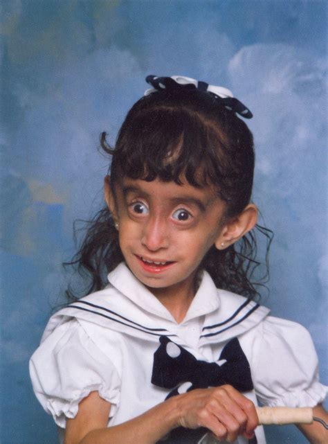 Ugliest Woman Alive Lizzie Velasquez