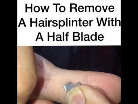 How to remove a hair splinter. - YouTube